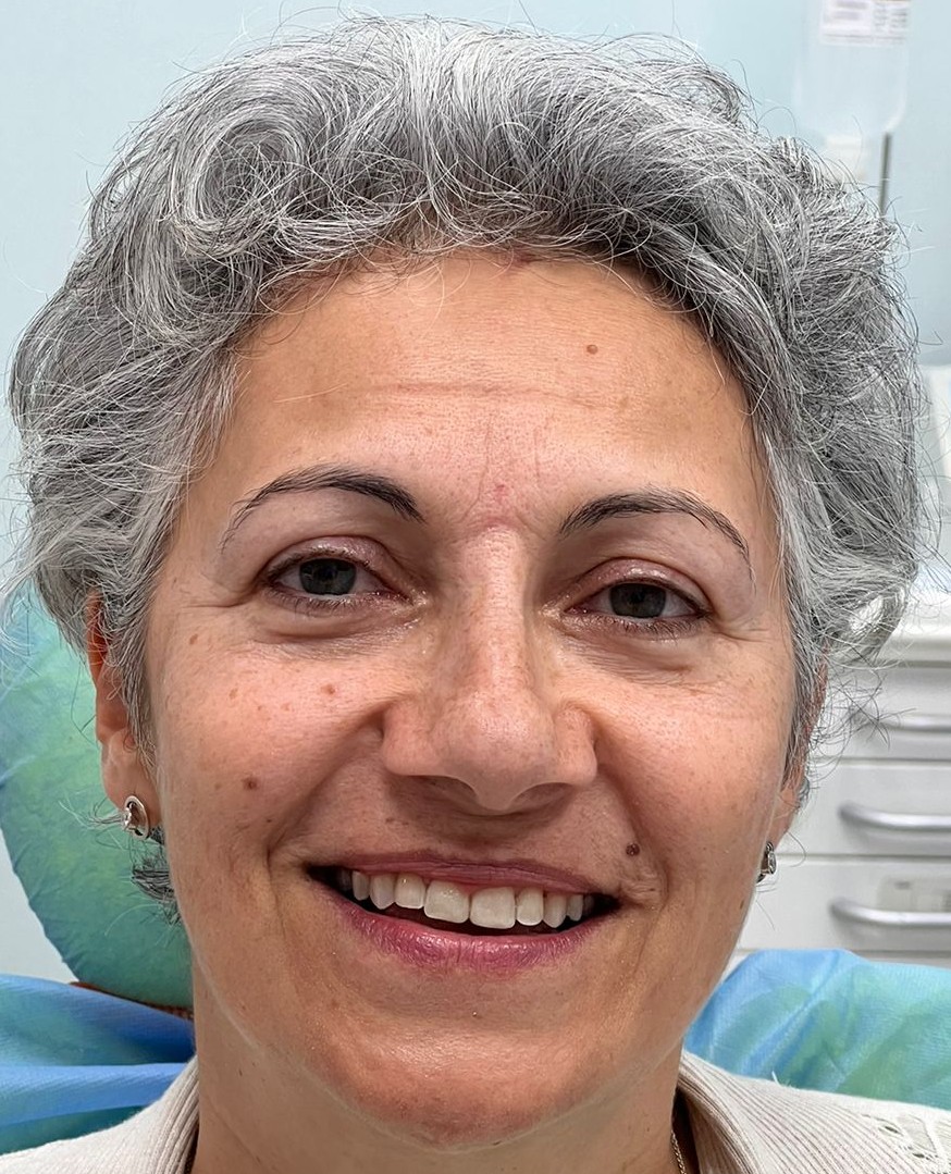Dental treatment after result 1