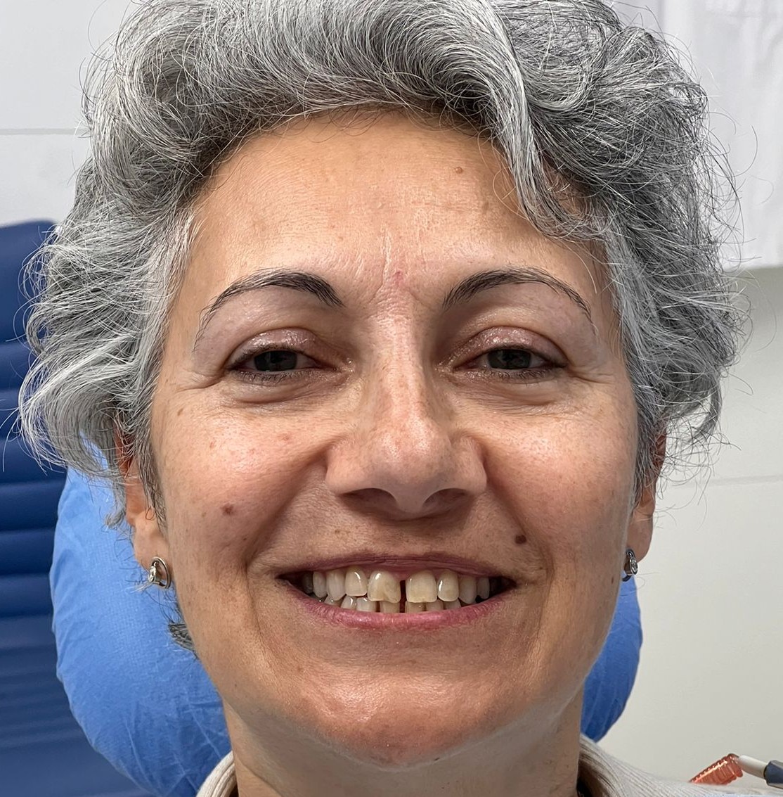 Dental treatment before result 1
