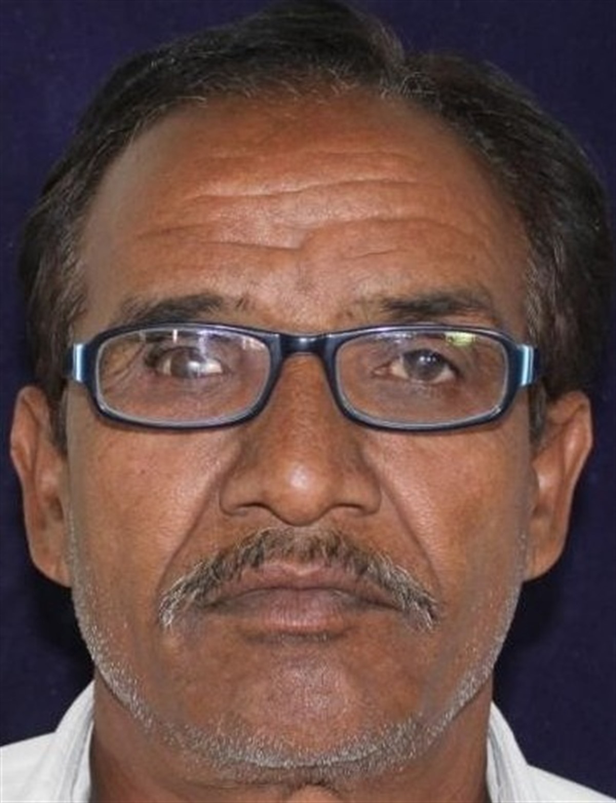 Dental treatment after result 4