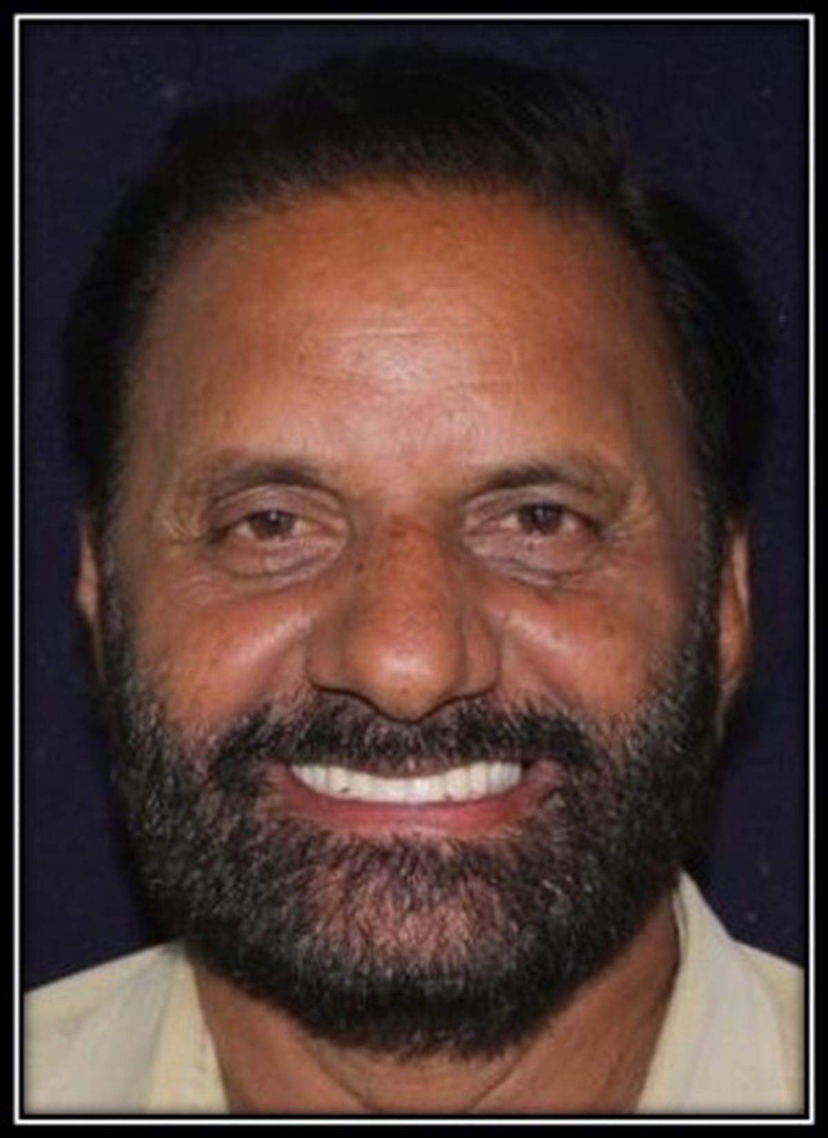 Dental treatment after result 3