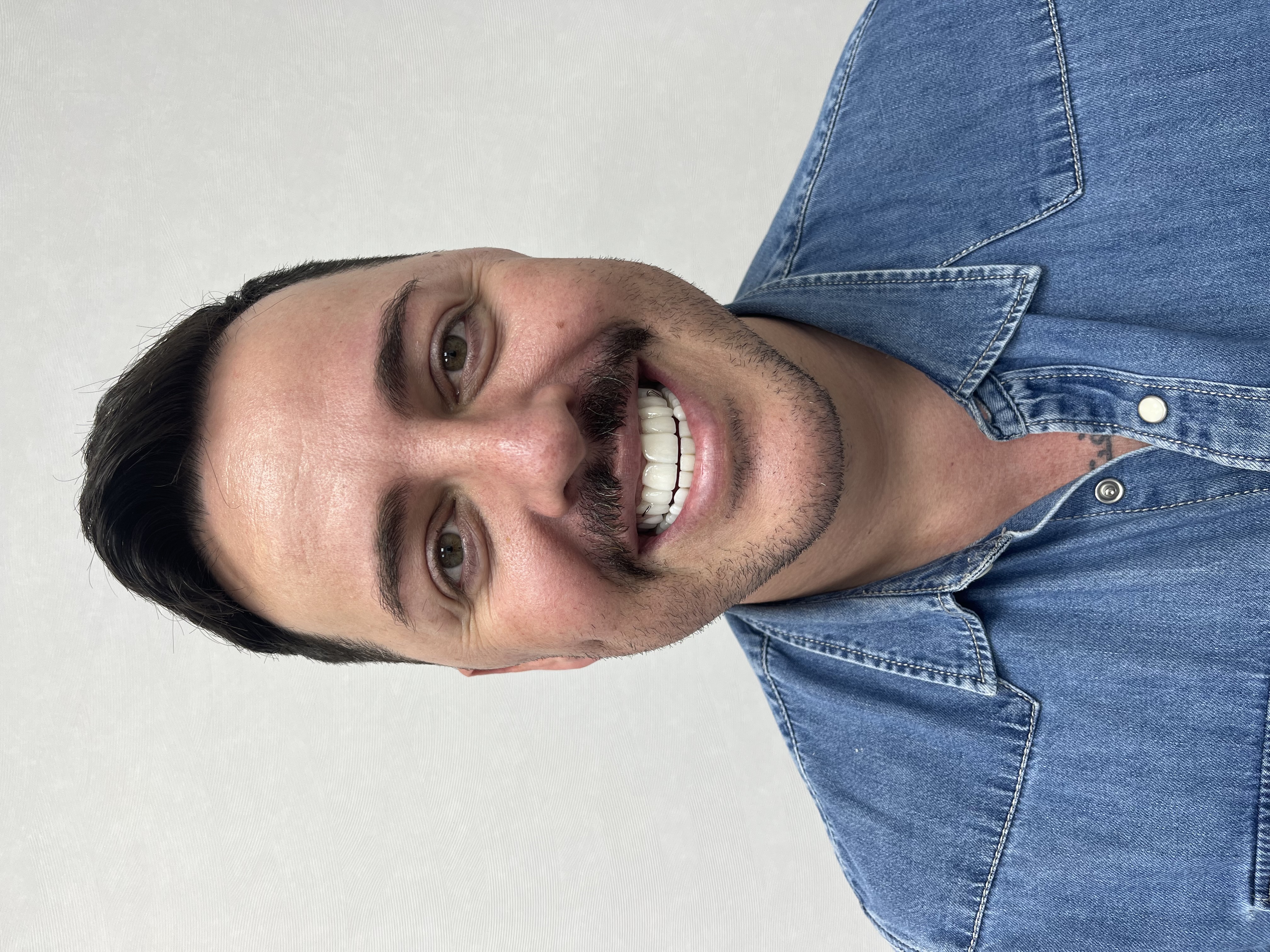 Patient smile result