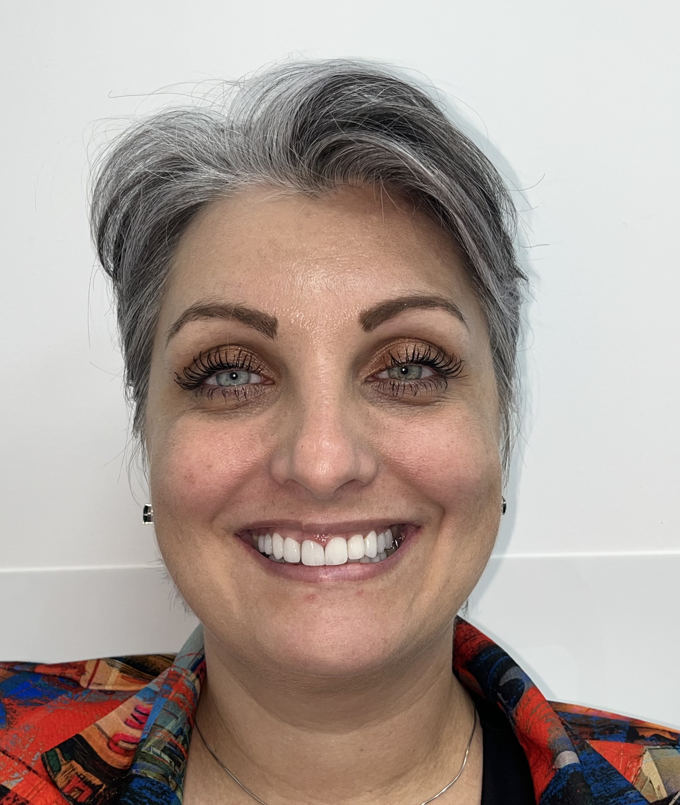 Dental treatment after result 2